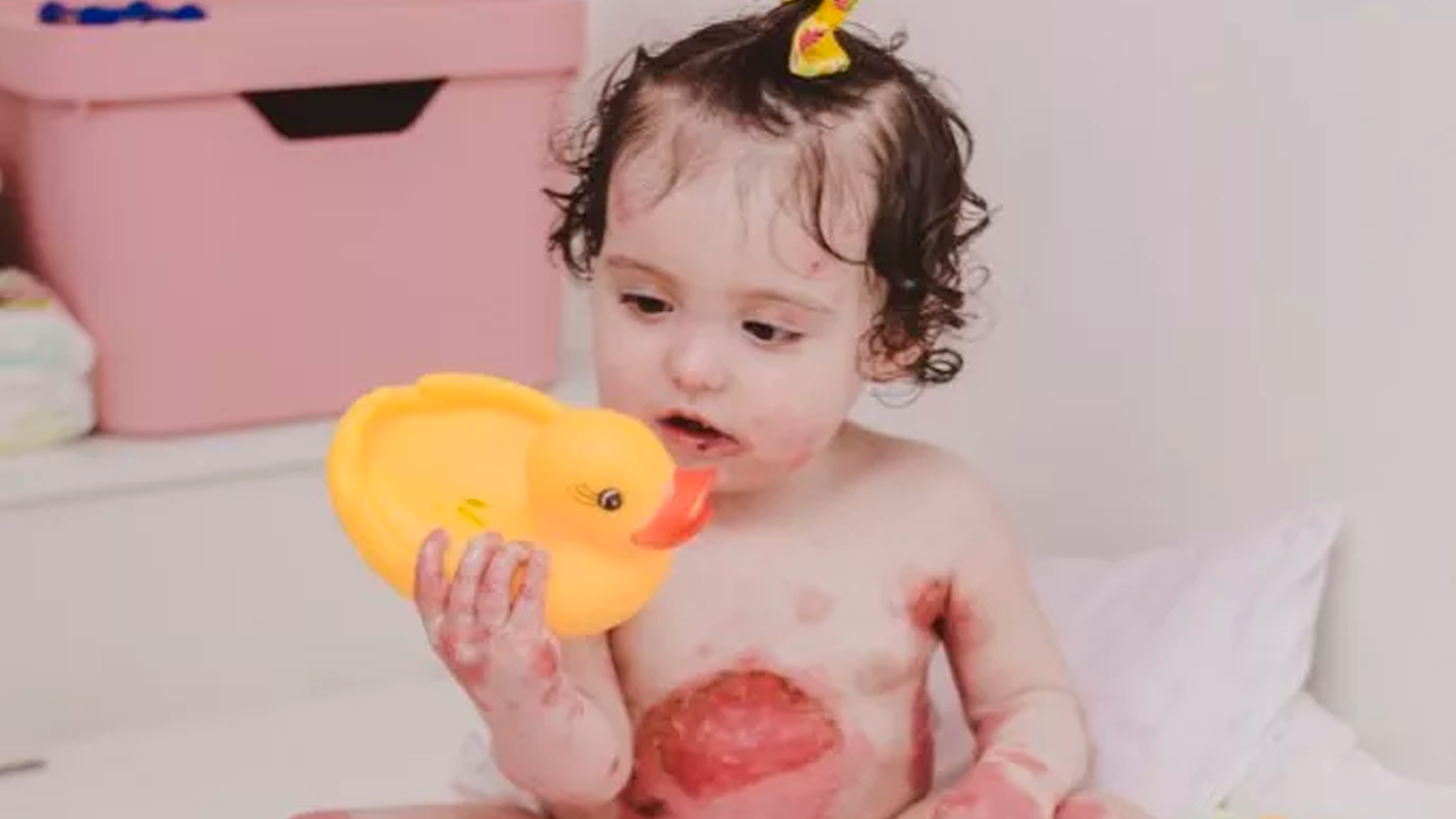 Júlia, sorridente apesar da dor, mostrando sua força